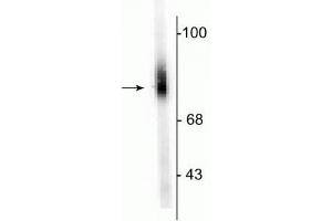 Western blot of human adrenal medulla lysate showing specific immunolabeling of the ~75 kDa DBH protein. (DBH anticorps  (N-Term))