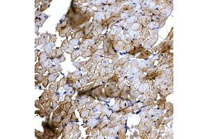 Immunohistochemistry of paraffin-embedded mouse kidney using Caspase-8 Rabbit pAb (ABIN6131530, ABIN6137970, ABIN6137972 and ABIN6213676) at dilution of 1:200 (40x lens).