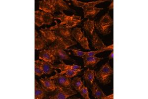 Immunofluorescence analysis of C6 cells using ITSN2 antibody (ABIN7268015) at dilution of 1:100.