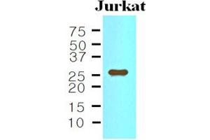 Western blot analysis: The Cell lysates of Jurkat (35ug) were resolved by SDS-PAGE, transferred to NC membrane and probed with anti-human IL-33 (1:500). (IL-33 anticorps)