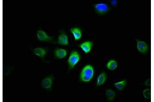 Immunofluorescence staining of A549 cells with ABIN7165056 at 1:166, counter-stained with DAPI. (PRMT1 anticorps  (AA 1-248))