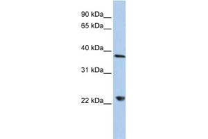WB Suggested Anti-DDX25 Antibody Titration:  0.