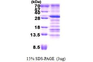SDS-PAGE (SDS) image for Ubiquitin-Conjugating Enzyme E2Z (UBE2Z) (AA 1-231) protein (His tag) (ABIN6387188) (UBE2Z Protein (AA 1-231) (His tag))