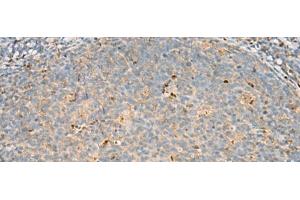 Immunohistochemistry of paraffin-embedded Human tonsil tissue using DNPEP Polyclonal Antibody at dilution of 1:60(x200) (Aspartyl Aminopeptidase anticorps)