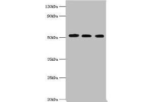 Western blot All lanes: Programmed cell death protein 4 antibody at 5 μg/mL Lane 1: Hela whole cell lysate Lane 2: MCF-7 whole cell lysate Lane 3: Jurkat whole cell lysate Secondary Goat polyclonal to rabbit IgG at 1/10000 dilution Predicted band size: 52, 51 kDa Observed band size: 52 kDa (PDCD4 anticorps  (AA 1-260))