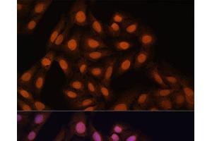 Immunofluorescence analysis of U-2 OS cells using CBX3 Polyclonal Antibody at dilution of 1:100. (CBX3 anticorps)