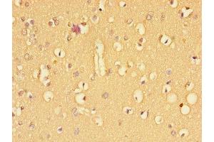 Immunohistochemistry of paraffin-embedded human brain tissue using ABIN7171961 at dilution of 1:100 (TGFBR2 anticorps  (AA 25-159))