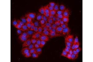 IF analysis of EVI1/MECOM using anti-EVI1/MECOM antibody (ABIN7599882).