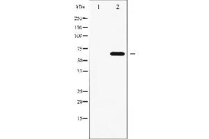 Western blot analysis of FRS2 phosphorylation expression in COS7 whole cell lysates,The lane on the left is treated with the antigen-specific peptide. (FRS2 anticorps  (pTyr436))