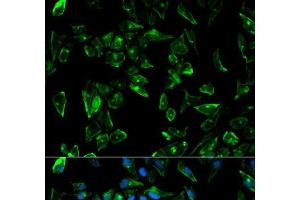Immunofluorescence analysis of HeLa cells using TPM3 Polyclonal Antibody (TPM3 anticorps)