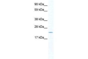 Western Blotting (WB) image for anti-SERTA Domain Containing 1 (SERTAD1) antibody (ABIN2460913) (SERTAD1 anticorps)