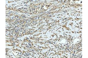 IHC analysis of FHL2 using anti-FHL2 antibody (ABIN7600782). (FHL2 anticorps  (AA 234-279))