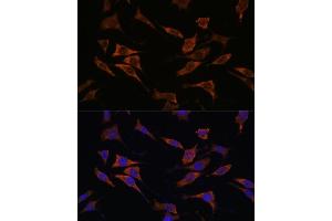 Immunofluorescence analysis of L929 cells using RPS17 antibody (ABIN7270016) at dilution of 1:100.