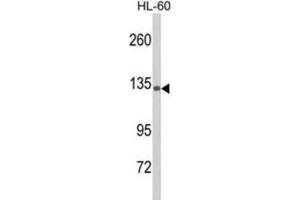 Western Blotting (WB) image for anti-Complement Component 5 (C5) antibody (ABIN3003812) (C5 anticorps)