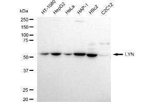 Western blotting analysis using LYN antibody (ABIN7800949).
