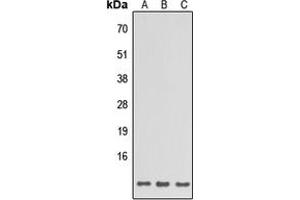 Western blot analysis of SPINK6 expression in HeLa (A), Raw264. (SPINK6 anticorps  (Center))