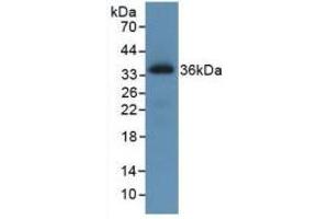 Western blot analysis of recombinant Human ROS1. (ROS1 anticorps)