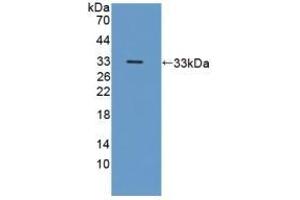 Detection of Recombinant ICAM3, Human using Polyclonal Antibody to Intercellular Adhesion Molecule 3 (ICAM3) (ICAM-3/CD50 anticorps  (AA 259-491))