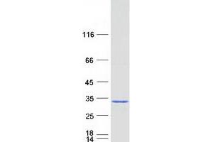 ES cell expressed Ras (ERAS) protein (Myc-DYKDDDDK Tag)