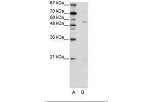 Image no. 1 for anti-Zinc Finger Protein 329 (ZNF329) (N-Term) antibody (ABIN202735) (ZNF329 anticorps  (N-Term))
