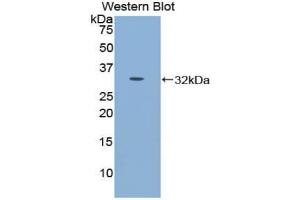 Detection of Recombinant CDH16, Mouse using Polyclonal Antibody to Cadherin 16 (CDH16) (Cadherin-16 anticorps  (AA 353-617))
