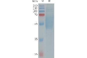 Human IL1RL2 Protein, His Tag on SDS-PAGE under reducing condition.