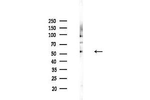 anti-Lipase I (LIPI) (Internal Region) antibody
