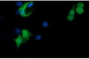 Image no. 2 for anti-Peptidyl Arginine Deiminase, Type IV (PADI4) (AA 299-588) antibody (ABIN1491356)