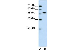 WB Suggested Anti-SOX11 Antibody Titration:  0. (SOX11 anticorps  (N-Term))