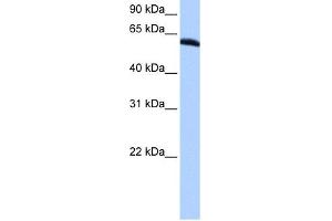 WB Suggested Anti-TRIP6 Antibody Titration:  0. (TRIP6 anticorps  (N-Term))
