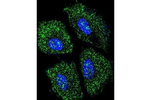Confocal immunofluorescent analysis of UGT2B15 Antibody (Center) with NCI-H460 cell followed by Alexa Fluor 488-conjugated goat anti-rabbit lgG (green).