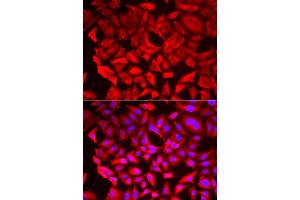 Immunofluorescence analysis of HeLa cell using SRP19 antibody. (SRP19 anticorps)