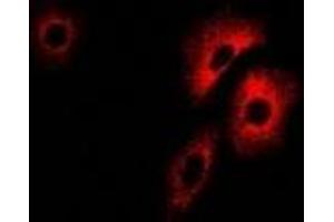 Immunofluorescent analysis of PCCB staining in U2OS cells. (PCCB anticorps)