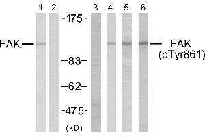 Western blot analysis using FAK (Ab-861) antibody (Line 1 and 2) and FAK (phospho-Tyr861) antibody (Line 3, 4, 5 and 6).