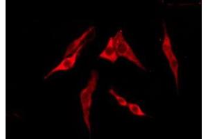 ABIN6276220 staining Hela by IF/ICC. (TAS2R13 anticorps  (Internal Region))