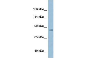 WB Suggested Anti-KPNB1 AntibodyTitration: 1. (KPNB1 anticorps  (N-Term))