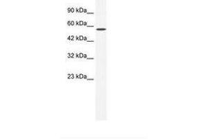 Image no. 1 for anti-Zinc Finger and BTB Domain Containing 44 (ZBTB44) (AA 221-270) antibody (ABIN6735970) (ZBTB44 anticorps  (AA 221-270))