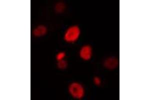 ABIN6274428 staining HuvEc cells by IF/ICC. (HIPK4 anticorps  (C-Term))