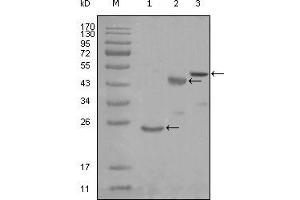 Western blot analysis using KARS mouse mAb against truncated Trx-KARS recombinant protein (1), truncated MBP-KARS (aa90-174) and full length KARS (aa1-188) transfected CHO-K1 cell lysate (3). (KARS anticorps)