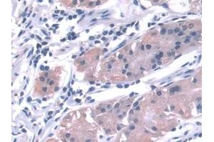 Detection of KLC1 in Human Stomach Tissue using Polyclonal Antibody to Kinesin Light Chain 1 (KLC1)