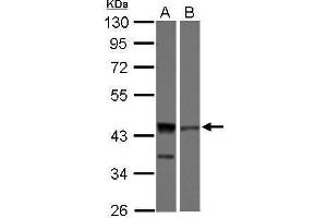 WB Image Sample (30 ug of whole cell lysate) A: 293T B: Jurkat 10% SDS PAGE antibody diluted at 1:1000 (DFFA anticorps)