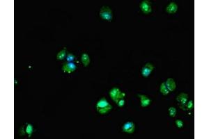Immunofluorescent analysis of MCF-7 cells using ABIN7149610 at dilution of 1:100 and Alexa Fluor 488-congugated AffiniPure Goat Anti-Rabbit IgG(H+L) (DHRS12 anticorps  (AA 1-271))