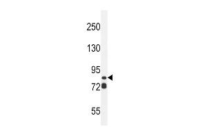 AS Antibody (N-term) (ABIN654956 and ABIN2844596) western blot analysis in ZR-75-1 cell line lysates (35 μg/lane).
