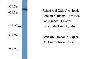Western Blotting (WB) image for anti-Cullin 4A (CUL4A) (Middle Region) antibody (ABIN2788865)