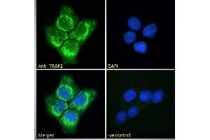 ABIN190911 Immunofluorescence analysis of paraformaldehyde fixed A431 cells, permeabilized with 0.
