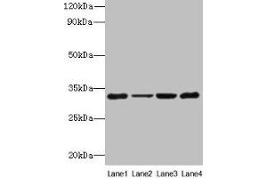 Western blot All lanes: PDCD1 antibody at 6 μg/mL Lane 1: 293T whole cell lysate Lane 2: Hela whole cell lysate Lane 3: K562 whole cell lysate Lane 4: Mouse stomach tissue Secondary Goat polyclonal to rabbit IgG at 1/10000 dilution Predicted band size: 32 kDa Observed band size: 32 kDa (PD-1 anticorps  (AA 21-170))