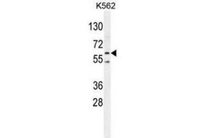 PRKAA2 (Thr172) Antibody western blot analysis in K562 cell line lysates (35µg/lane). (PRKAA2 anticorps  (Middle Region, Thr172))