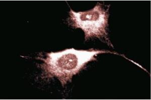 Immunofluorescence staining of Human Endothelial cells. (CD38 anticorps  (AA 171-292))