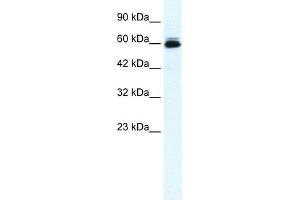WB Suggested Anti-KCNH5 Antibody Titration:  0.