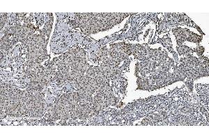IHC analysis of SAMHD1 using anti-SAMHD1 antibody (ABIN7601514).